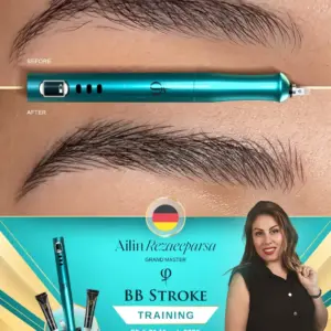BB Stroke Duitsland